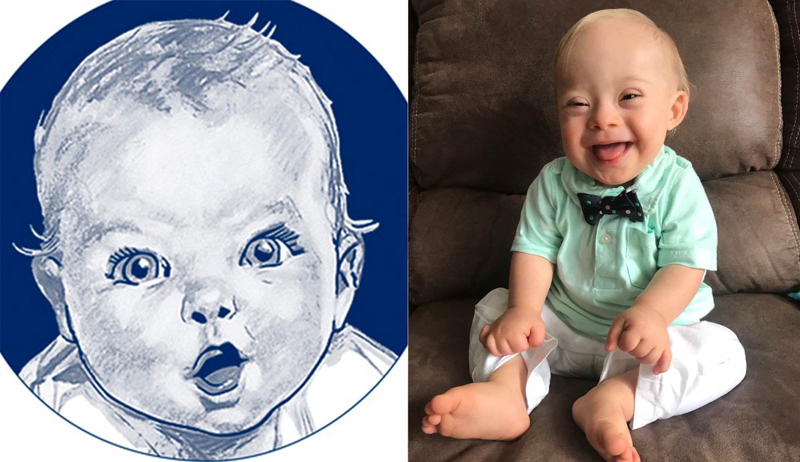 For The First Time Ever, A Baby With Down Syndrome Won The Gerber Photo