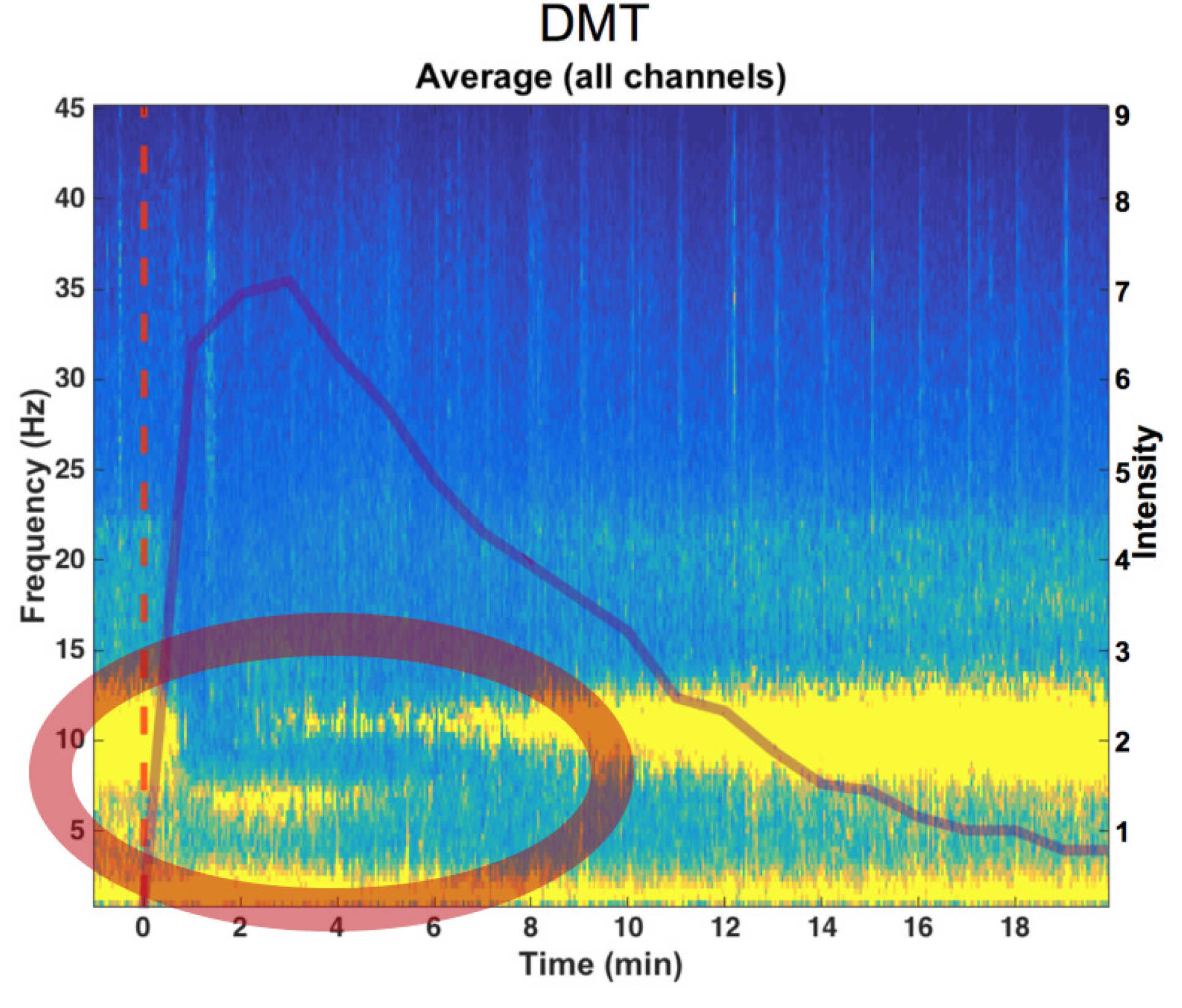 DMT brainwaves
