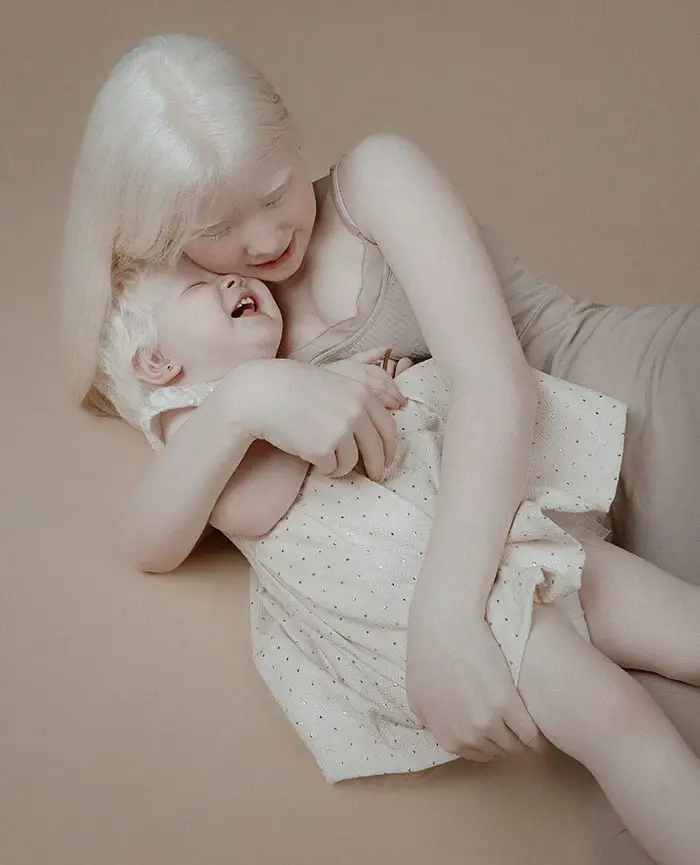 albino sisters