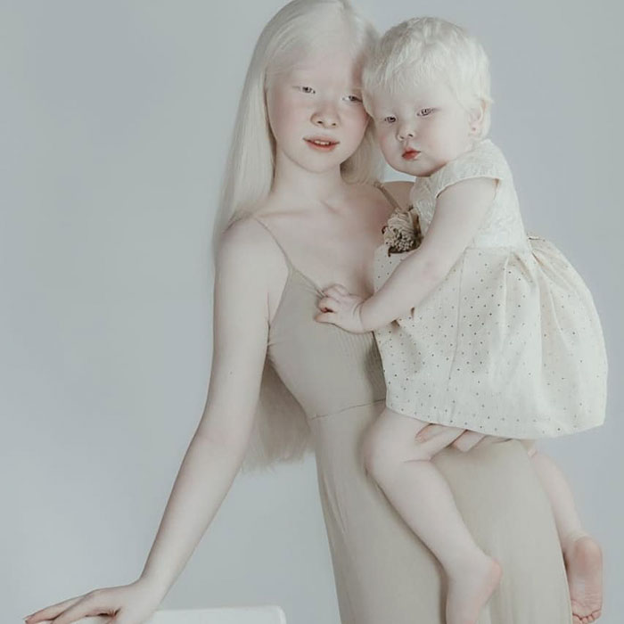 Albino Sisterso