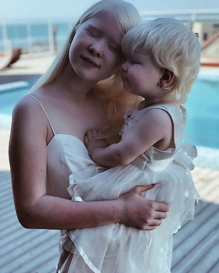 albino sisters photoshoot kazakhstan asel kalaganova 5e280003b2e63 700 1