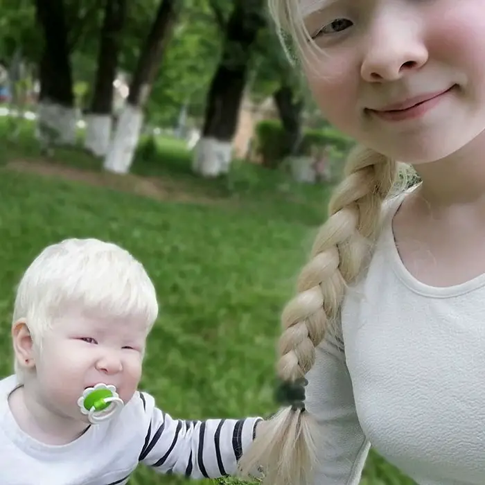 albino sisters photoshoot kazakhstan asel kalaganova 5e280005567a0 700