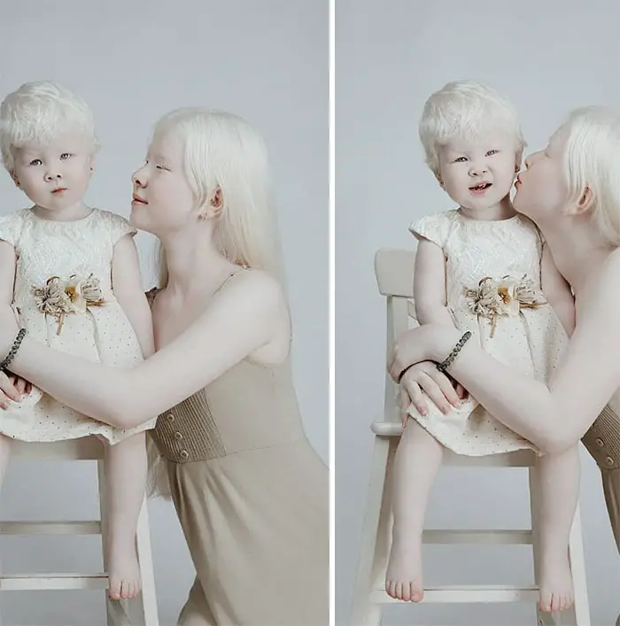 albino sisters asel and kamila